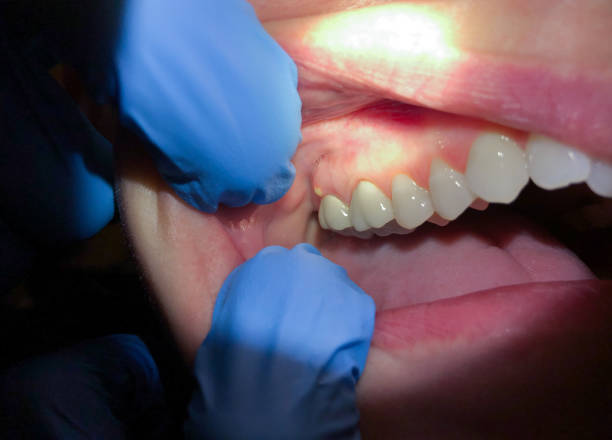 Best After-Hours Dental Trauma Care in Wrightsville, AR